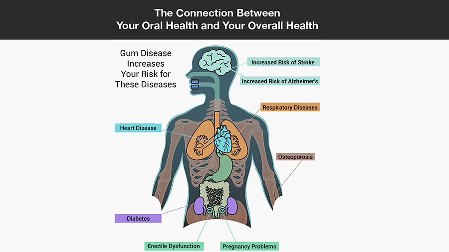 Oral Health and Overall Health